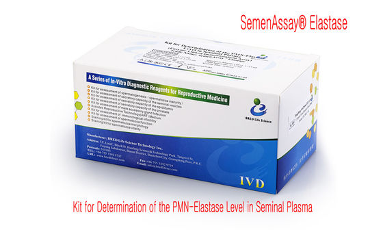 40T/Kit Συσκευή κατακερματισμού DNA σπέρματος με μέθοδο SCD και έγκριση CE για ακριβή δοκιμή κατακερματισμού DNA