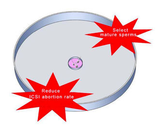 Το Hyaluronic όξινο πιάτο επιλογής σπέρματος για ICSI IVF μειώνει το ποσοστό ακούσιας διακοπής εγκυμοσύνης