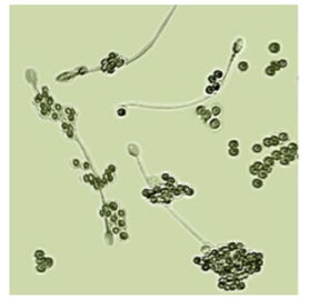 Αναπαρ:άγω-011 αρσενική εξάρτηση δοκιμής γονιμότητας για την αρσενική διάγνωση στειρότητας σπερματοζωαρίων προσδιορισμού