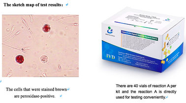 Δείγμα σπέρματος Κιτ δοκιμής λευκοκυττάρων 40T/Kit για προσυμπτωματικό έλεγχο λοιμώξεων της αναπαραγωγικής οδού ανδρών